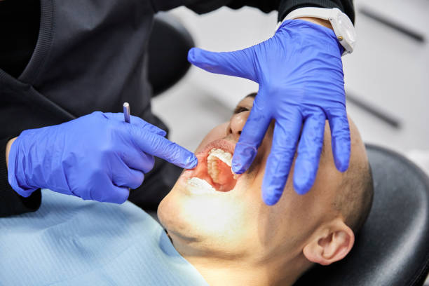 Best Emergency Tooth Extraction in Rockville, CT
